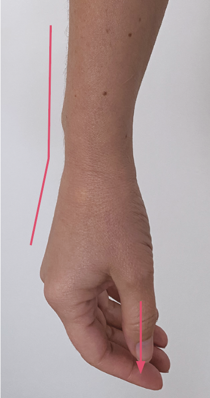 1 Hand at the side of the body in a neutral position. 